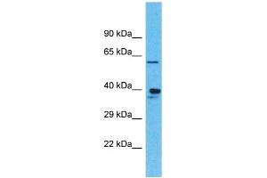 Western Blotting (WB) image for anti-Olfactory Receptor, Family 4, Subfamily K, Member 1 (OR4K1) (C-Term) antibody (ABIN2791739) (OR4K1 anticorps  (C-Term))