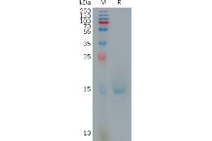 Interleukin 10 (IL10) (AA 19-178) protein (His tag)