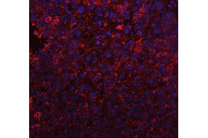 IF analysis of BI-1/TMBIM6 using anti-BI-1/TMBIM6 antibody (ABIN7603199).