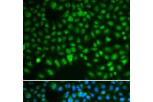 Immunofluorescence analysis of HeLa cells using DLGAP5 Polyclonal Antibody (DLGAP5 anticorps)