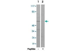 Western blot analysis of extracts from K-562 cells, using ACVRL1 polyclonal antibody . (ACVRL1 anticorps)