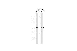 All lanes : Anti-NCSTN Antibody (N-Term) at 1:2000 dilution Lane 1: Jurkat whole cell lysates Lane 2: A431 whole cell lysates Lysates/proteins at 20 μg per lane.