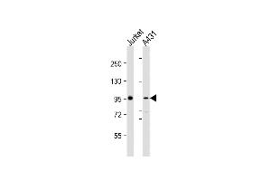 All lanes : Anti-NCSTN Antibody (N-Term) at 1:2000 dilution Lane 1: Jurkat whole cell lysates Lane 2: A431 whole cell lysates Lysates/proteins at 20 μg per lane. (Nicastrin anticorps  (AA 99-133))