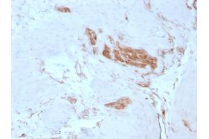 Formalin-fixed, paraffin-embedded human Tonsil stained with Fodrin Mouse Monoclonal Antibody (SPTAN1/3351).