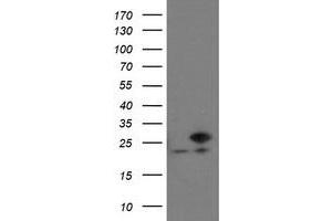 Western Blotting (WB) image for anti-Prefoldin Subunit 3 (PFDN3) antibody (ABIN1501703) (VBP1 anticorps)