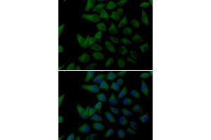 Immunofluorescence analysis of U20S cell using PLOD2 antibody. (PLOD2 anticorps)