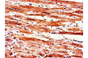 Immunohistochemistry of paraffin-embedded human heart tissue using ABIN7160397 at dilution of 1:100