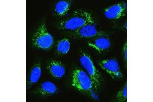 IF analysis of IQGAP1 using anti-IQGAP1 antibody (ABIN6719262). (IQGAP1 anticorps)