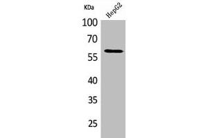 Western Blot analysis of HepG2 cells using HEXA Polyclonal Antibody (Hexosaminidase A anticorps  (Internal Region))