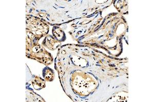 IHC analysis of SMARCA2/BRM using anti-SMARCA2/BRM antibody (ABIN7601969).