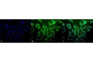 Immunocytochemistry/Immunofluorescence analysis using Mouse Anti-Ubiquitin Monoclonal Antibody, Clone 5B9-B3 (ABIN361810 and ABIN361811). (Ubiquitin anticorps)