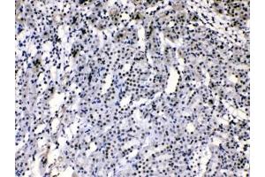 IHC testing of rat kidney tissue with hnRNP A1 antibody at 1ug/ml.