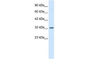 SMARCA2 antibody used at 0. (SMARCA2 anticorps  (Middle Region))