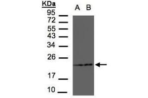 Figure 1. (RAMP2 anticorps  (AA 111-175))