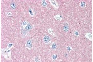 Human Brain, Cortex (formalin-fixed, paraffin-embedded) stained with THY1 antibody ABIN396935 at 10 ug/ml followed by biotinylated anti-mouse IgG secondary antibody ABIN481714, alkaline phosphatase-streptavidin and chromogen.
