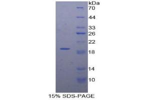 SDS-PAGE analysis of Human DVL1 Protein. (DVL1 Protéine)