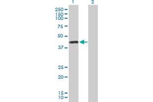 Western Blot analysis of PTDSS1 expression in transfected 293T cell line by PTDSS1 MaxPab polyclonal antibody. (PTDSS1 anticorps  (AA 1-473))