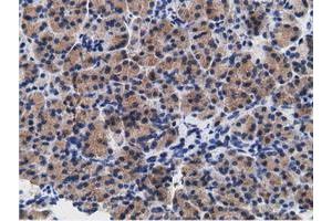 Immunohistochemical staining of paraffin-embedded Human colon tissue using anti-CD80 mouse monoclonal antibody. (CD80 anticorps)