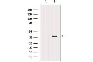 Western blot analysis of extracts from Mouse muscle, using RHO Antibody. (Rho-related GTP-binding protein anticorps)