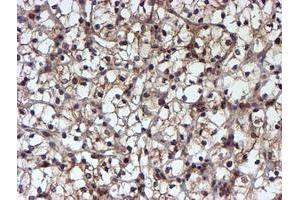 Image no. 1 for anti-Histidyl-tRNA Synthetase 2, Mitochondrial (Putative) (HARS2) antibody (ABIN1498584)