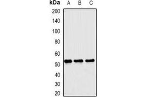 Western blot analysis of Matrilin 3 expression in mouse liver (A), mouse brain (B), rat liver (C) whole cell lysates. (Matrilin 3 anticorps)
