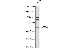 Western blot analysis of extracts of HeLa cells, using CBX6 antibody (ABIN6127558, ABIN6138026, ABIN6138027 and ABIN6221185) at 1:1000 dilution. (CBX6 anticorps  (AA 80-180))
