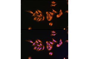 Immunofluorescence analysis of U-2 OS cells using MRPS27 Rabbit pAb  at dilution of 100 (40x lens). (MRPS27 anticorps  (AA 255-414))