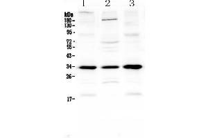 Western blot analysis of MyD88 using anti-MyD88 antibody . (MYD88 anticorps  (AA 12-263))
