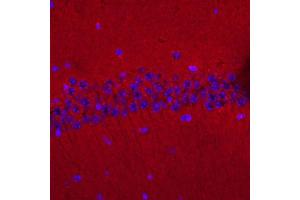 Immunolabeling of mouse hippocampus identifying GluR2 (Cat no (ABIN1304677), red).