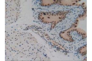 IHC-P analysis of Mouse Vas Deferens Tissue, with DAB staining. (IRF2 anticorps  (AA 1-349))
