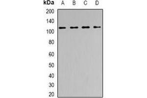 Western blot analysis of SNF2H expression in PC3 (A), HepG2 (B), mouse spleen (C), mouse brain (D) whole cell lysates. (SMARCA5 anticorps)