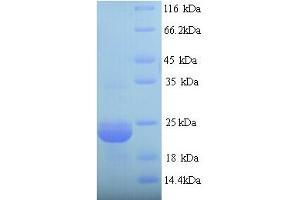 SDS-PAGE (SDS) image for YOAJ (AA 26-232) protein (ABIN5714286) (YOAJ (AA 26-232) Protéine)