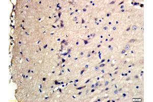 Formalin-fixed and paraffin embedded rat brain labeled with Rabbit Anti-TSC2(Ser1798) Polyclonal Antibody, Unconjugated (ABIN712121) at 1:200 followed by conjugation to the secondary antibody and DAB staining (Tuberin anticorps  (pSer1798))