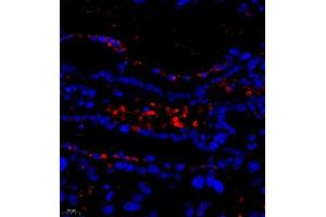 Immunofluorescence of paraffin embedded mouse placenta using DEPDC1 (ABIN7073717) at dilution of 1:500 (400x lens)