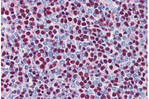 Human Spleen (formalin-fixed, paraffin-embedded) stained with XRCC5 antibody ABIN337306 at 2. (XRCC5 anticorps  (AA 462-475))