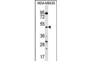 SNX4 Antibody (C-term) (ABIN656781 and ABIN2845999) western blot analysis in MDA-M cell line lysates (35 μg/lane). (Sorting Nexin 4 anticorps  (C-Term))