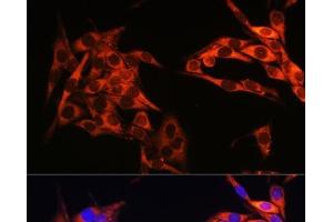 Immunofluorescence analysis of HeLa cells using PIK3CA Polyclonal Antibody at dilution of 1:100. (PIK3CA anticorps)