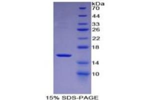 SDS-PAGE of Protein Standard from the Kit  (Highly purified E. (MBL2 Kit ELISA)