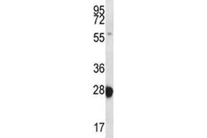 RAB27B antibody western blot analysis in MDA-MB435 lysate. (RAB27B anticorps  (AA 121-150))