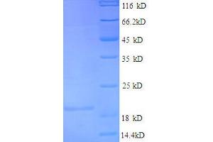 Interleukin 4 (IL4) (AA 25-153), (full length) protein (His tag)