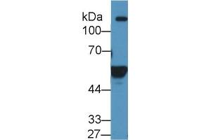 Detection of ALDH1A2 in Human K562 cell lysate using Polyclonal Antibody to Aldehyde Dehydrogenase 1 Family, Member A2 (ALDH1A2)