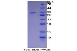 SDS-PAGE analysis of Mouse Smad6 Protein. (SMAD6 Protéine)