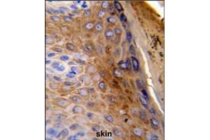 Formalin-fixed and paraffin-embedded human skin reacted with KRT10 Antibody , which was peroxidase-conjugated to the secondary antibody, followed by DAB staining.