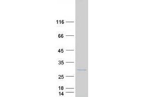 Validation with Western Blot