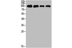 Western Blot analysis of 1,mouse-kidney 2,mouse-heart 3,3T3 4,Hela cells using primary antibody diluted at 1:500(4 °C overnight). (ACO2 anticorps  (AA 421-470))