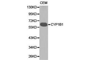 Western Blotting (WB) image for anti-Cytochrome P450, Family 1, Subfamily B, Polypeptide 1 (CYP1B1) antibody (ABIN1872164) (CYP1B1 anticorps)