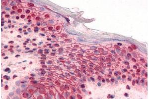 Human Skin (formalin-fixed, paraffin-embedded) stained with GLI2 antibody ABIN351530 at 5 ug/ml followed by biotinylated goat anti-rabbit IgG secondary antibody ABIN481713, alkaline phosphatase-streptavidin and chromogen. (GLI2 anticorps  (AA 46-60))