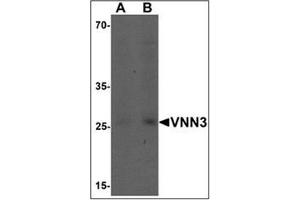 Western blot analysis of VNN3 in human brain tissue lysate with VNN3 Antibody  at (A) 0. (VNN3 anticorps  (C-Term))