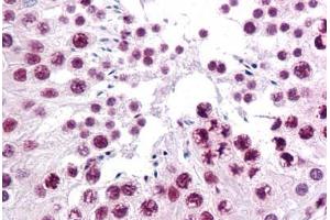 Human Testis: Formalin-Fixed, Paraffin-Embedded (FFPE) (SIRT1 anticorps  (AA 456-555))
