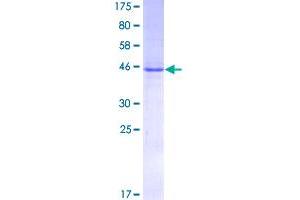 Image no. 1 for Interleukin 6 (IL6) (AA 1-212) protein (GST tag) (ABIN1307834)